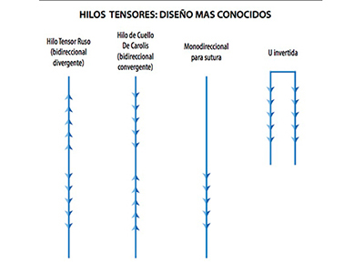 Hilos Tensores diseños
